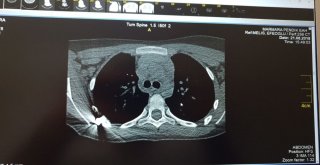 Pendikte Parkta Oynarken Silahlı Saldırıya Uğrayan Çocuk Konuştu