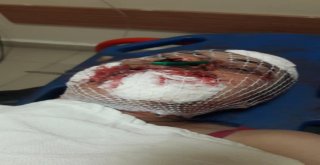 Eski Eşinin Yüzünü Şişeyle Parçaladı