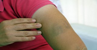 İstanbuldan Gelen Kızına Pasta Sürprizi Yapmak İstedi, Hastanelik Oldu