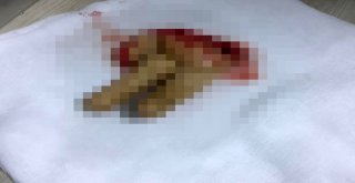 Elini Makineye Kaptırdı, Parmakları Koptu