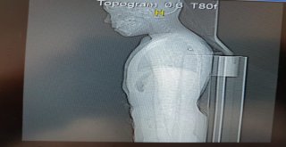 Pendikte Parkta Oynarken Silahlı Saldırıya Uğrayan Çocuk Konuştu