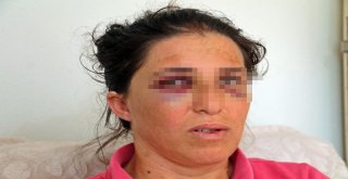 İstanbuldan Gelen Kızına Pasta Sürprizi Yapmak İstedi, Hastanelik Oldu