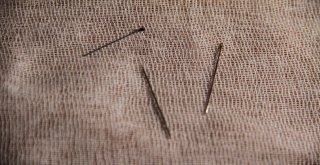 Kedi Üzerine Atlayınca, 15 İğne Yuttu, 9U Henüz Çıkartılamadı