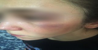Antrenörü Tarafından Darp Edildiği İddia Edilen Milli Sporcunun Annesi Konuştu