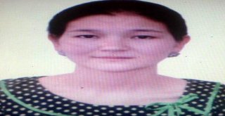 Olay Yerinden Getirilen Kafa Derisi Ve Saç Dokusu Tekrar Kafaya Dikildi