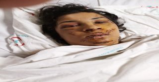 Eski Eşinin Yüzünü Şişeyle Parçaladı