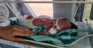 Kalbi Duran Yeni Doğmuş Bebeğin İmdadına Ambulans Helikopter Yetişti