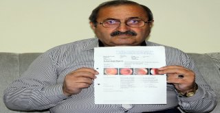 11 Yıllık Kanser Savaşını Ilgaz Dağlarında Üretilen Bal Sayesinde Kazandı