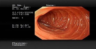 Kedi Üzerine Atlayınca, 15 İğne Yuttu, 9U Henüz Çıkartılamadı