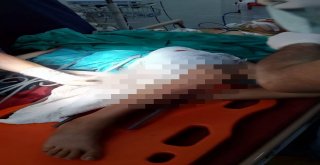 Bacağına Demir Çubuk Saplanan Çocuğun İmdadına Afad Yetişti