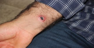 Sivasta Şarbon Şüphesiyle Köyde Panik