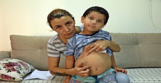 Antalyada 5 Yaşındaki Hiperaktif Çocuğa Kreşte Darp İddiası