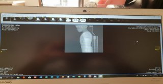 Pendikte Parkta Oynarken Silahlı Saldırıya Uğrayan Çocuk Konuştu