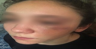 Antrenörü Tarafından Darp Edildiği İddia Edilen Milli Sporcunun Annesi Konuştu