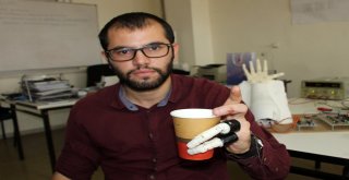 İki Parmağını Kaybeden Mühendislik Öğrencisi, Kendine Protez Parmak Yaptı
