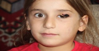 Sivasta Şarbon Şüphesiyle Köyde Panik