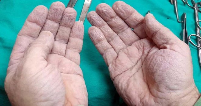 Cerrahın Elleri Sosyal Medyayı Salladı