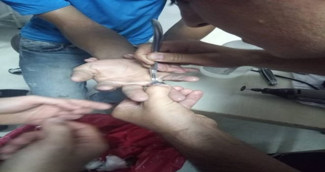 16 Yaşındaki Gence Afaddan Yüzük Operasyonu